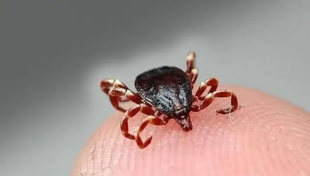 Çorum'da KKKA hastalığı şüphesiyle tedavi gören kişi hayatını kaybetti