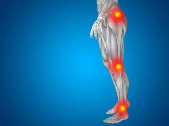 Romatizma nedir? Romatizma belirtileri ve tedavisi