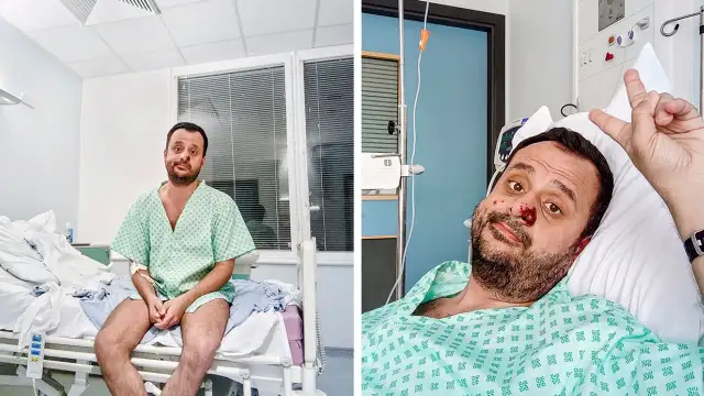 Dünya Sağlık Örgütü, Londra'da maymun çiceği virüsüne yakalanan Türk vatandaşının fotoğraflarını yayınladı