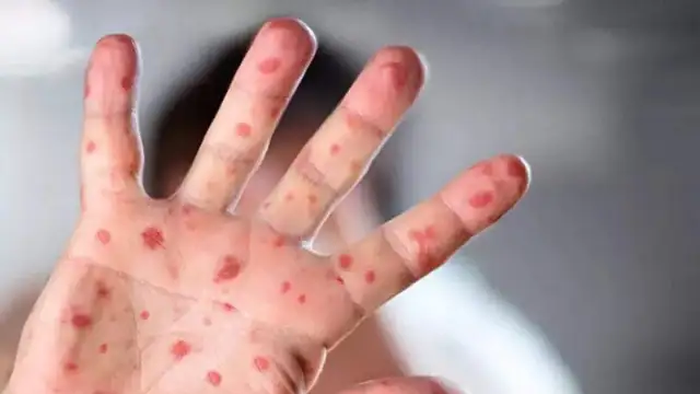 Arjantin'de bir yük gemisi M çiçeği virüsü şüphesiyle karantinaya alındı