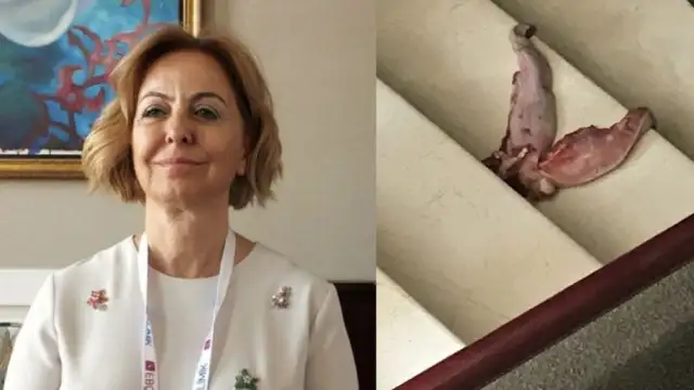 Dr. Esin Davutoğlu Şenol, adım adım planlanan bir cinayetin hedefi olduğunu açıkladı: Kapısına iki tane dana dili atıldı