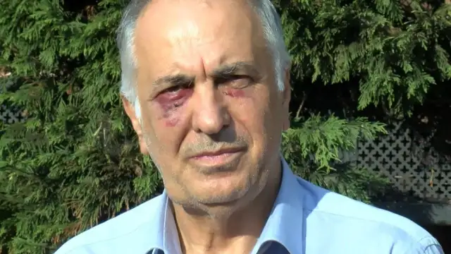 Saldırıya uğrayan Cemevi başkanı o anları anlattı: Ankara'daki saldırıların devamını yaşadım
