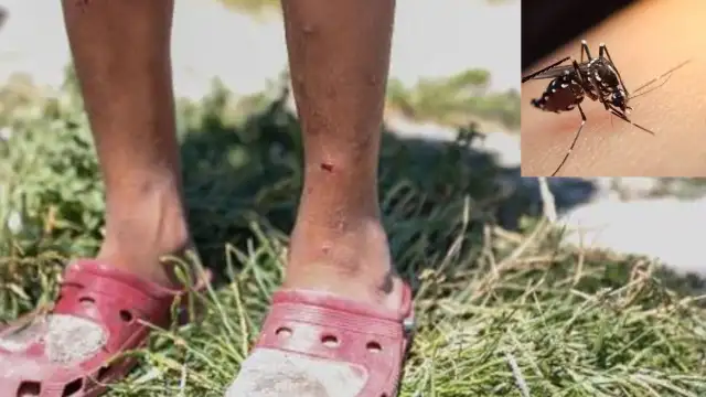 İstanbullular bu haber sizi ilgilendiriyor: Aedes sivrisineği kentte yayılıyor, Zika virüsü bulaştırıyor!