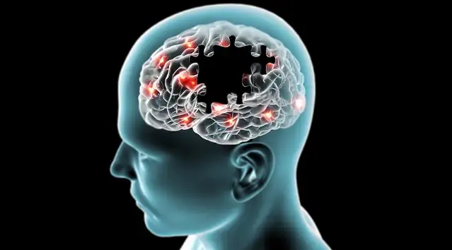 Alzheimer'ı yavaşlatan yeni ilaç onaylandı