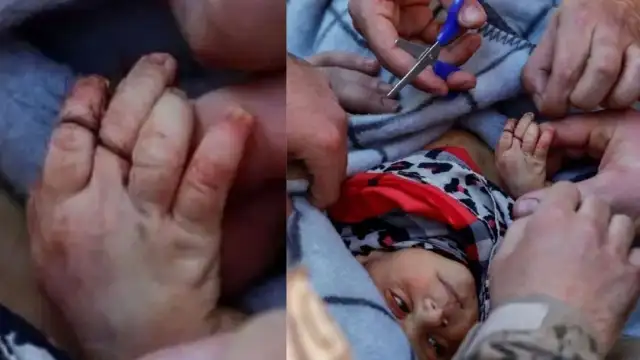 20 günlük bebek elinde annesinin bir tutam saçıyla enkazdan kurtarıldı