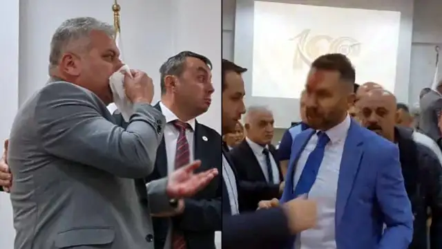 MHP'li belediye meclis üyesi, CHP'li üyenin burnunu kırdı