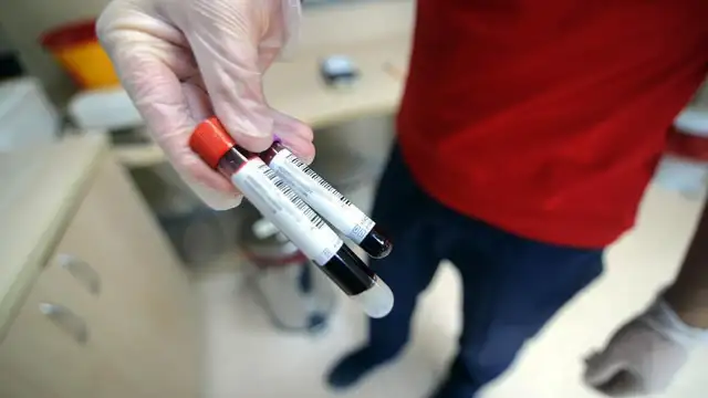 Araştırma: Kan testiyle hızlı ve yavaş yaşlanan organlar tespit edilebilir