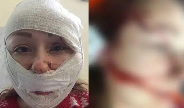Ukraynalı eşinin yüzünü falçatayla doğrayan erkek tahliye edildi! Hayatına yeniden başlayacakmış...