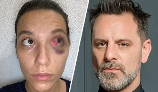 Deniz Bulutsuz'a şiddet uyguladığı iddia edilen Ozan Güven, setlere dönüyor