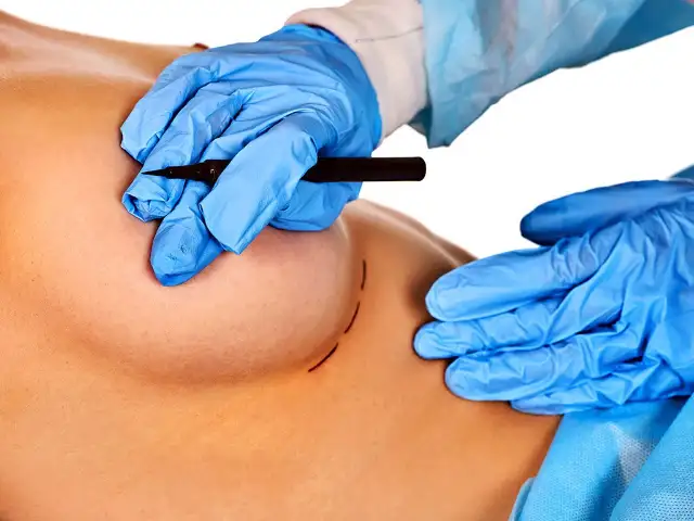 Ünlü estetik doktoruna çıplak meme soruşturması