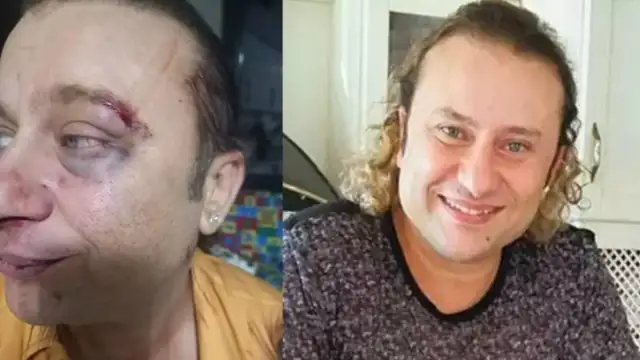 Onur Akay saldırıya uğradığını açıkladı: 'Kadir Doğulu için, tarikat için' diyerek vurdu