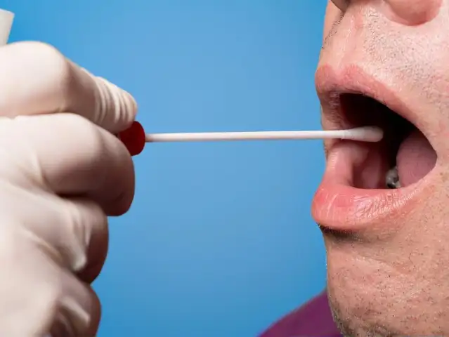 Prostat kanserini erken teşhis edebilen tükürük testi