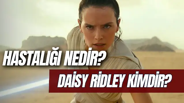 Daisy Ridley Kimdir? Hastalığı Nedir? Kaç Yaşında?