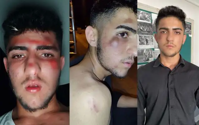 Ankara’da polisten kaçan 3 kardeşe işkence