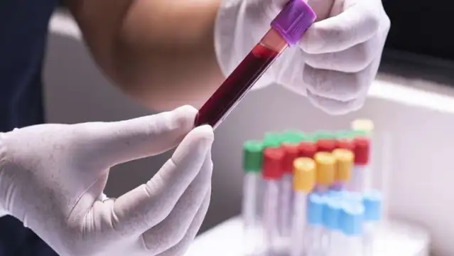 50 yıl süren bir araştırmanın ardından yeni bir kan grubu keşfedildi