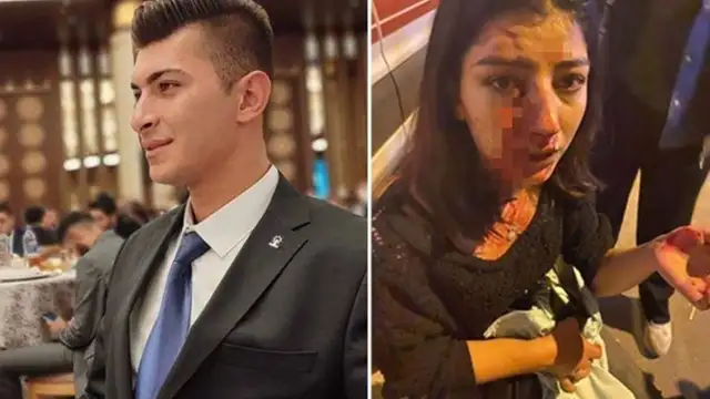 AKP’li başkandan kadına şiddet: Burnu kırılan genç kız ameliyata alındı