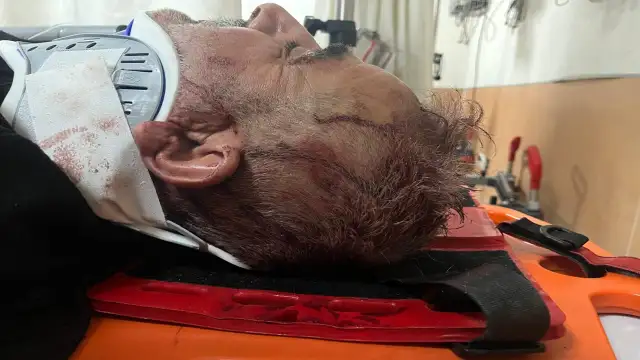 Erciş'te kızını şiddetten koruyan baba öldüresiye dövüldü!