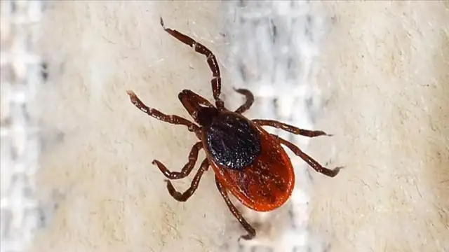 Sivas'ta KKKA hastalığı şüphesiyle tedavi gören kadın hayatını kaybetti