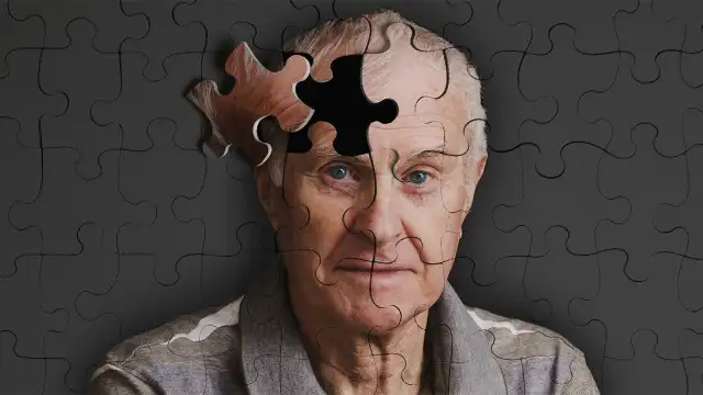 Bilim insanlarından umut veren keşif: Alzheimer’ın nedeni bulundu mu?